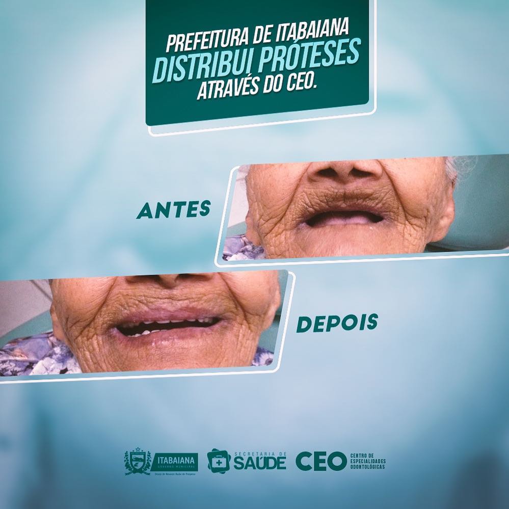 Ontem (02), realizamos mais uma entrega de prótese dentária no CEO. Dona Maria, de 94 anos, umas das beneficiárias do mês, nunca havia usado prótese, e foi através desse serviço que pudemos devolver a ela a facilidade de mastigar e a vontade de sorrir! 🤗 🏾⚕SMS#DesejoDeRenascer#RazãoDeProsperar